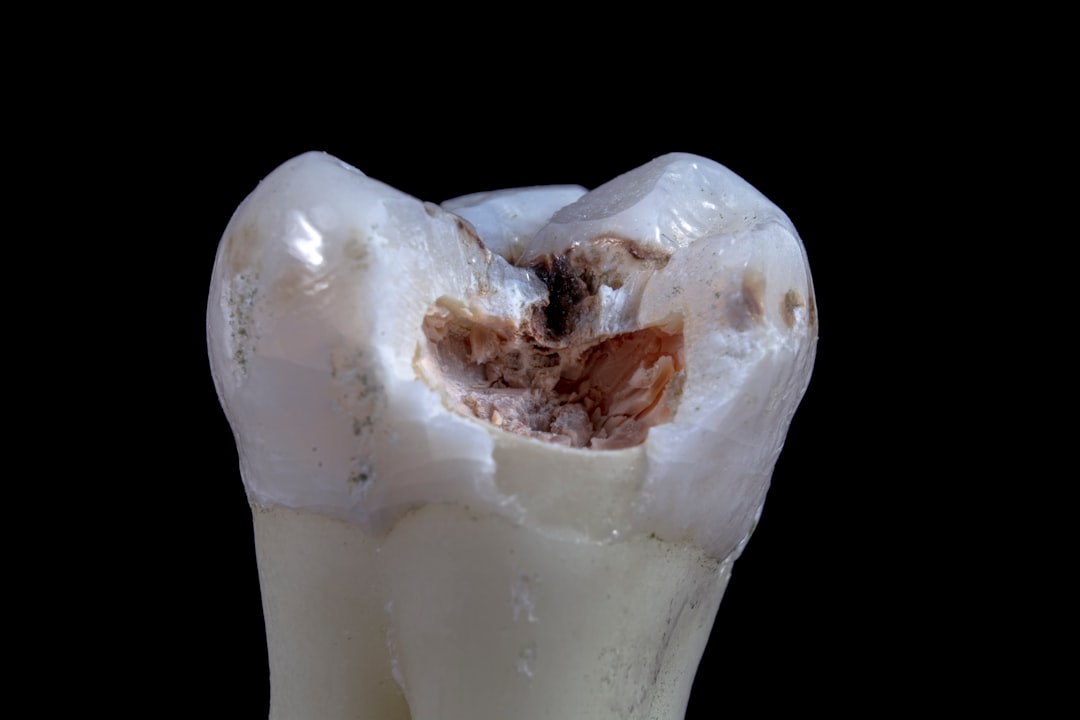 tooth jawdnice