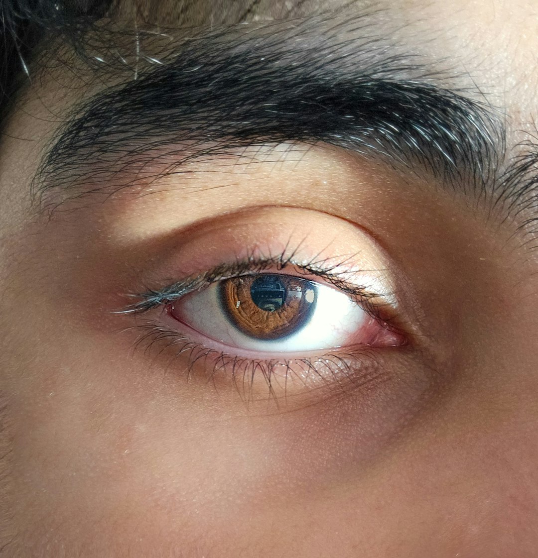 eye strain