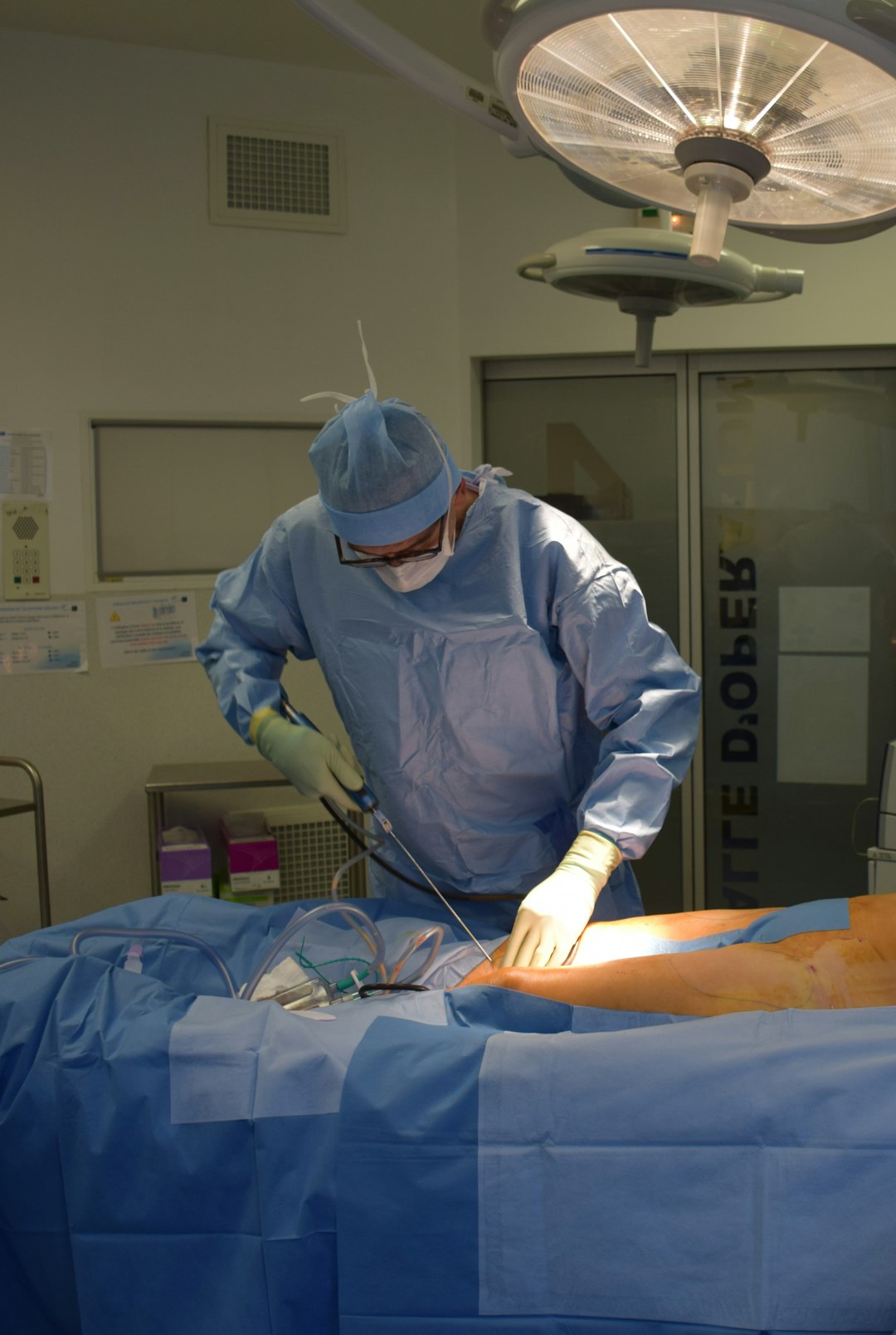 A visual overview of a liposuction procedure setup.