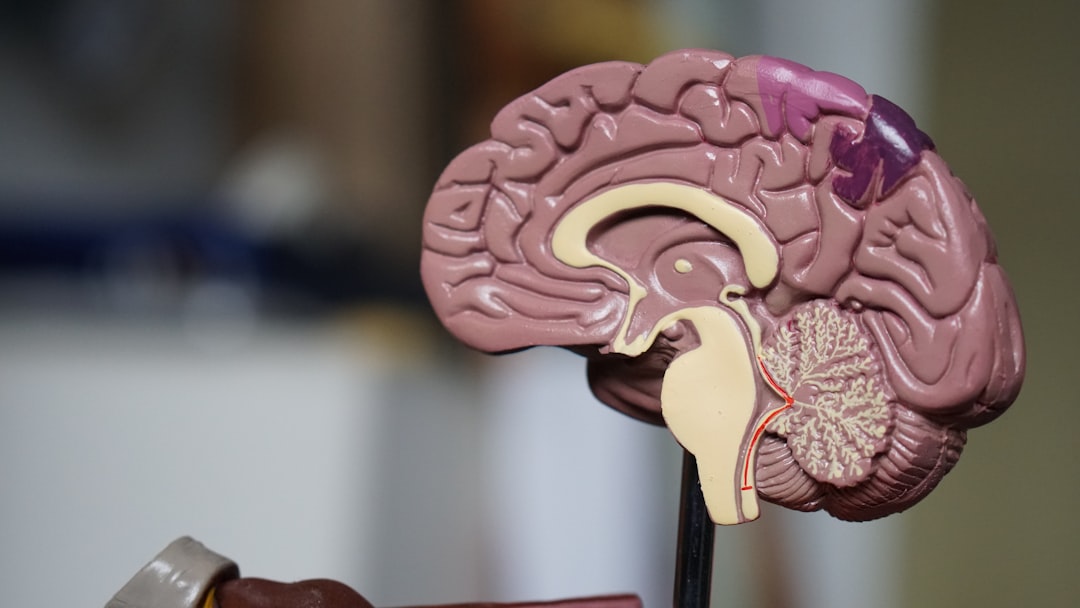 Alzheimer ile ilgili görsel